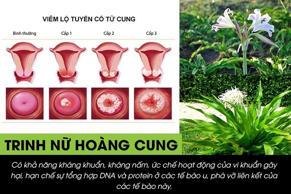 Viêm lộ tuyến uống trinh nữ hoàng cung có tốt không?