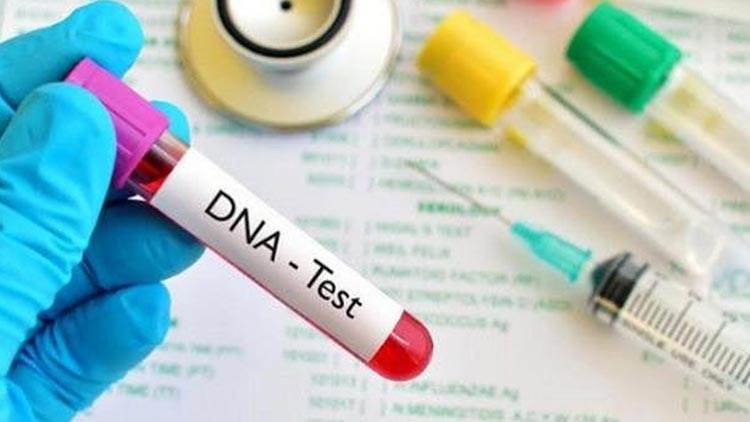 1- Xét nghiệm máu tế bào ADN 1