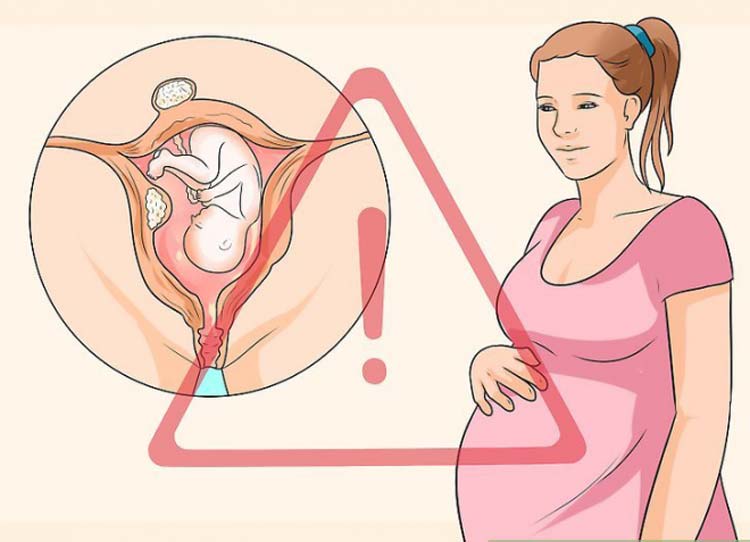 Ảnh hưởng tới quá trình mang thai 1