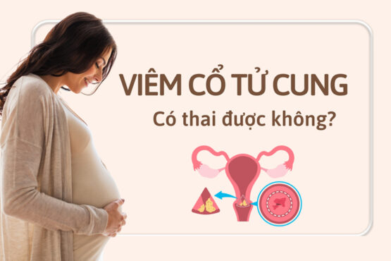 Bị viêm cổ tử cung có thai được không?